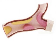 2010-11-4-organos_artificiales_med