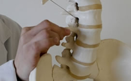 2011-04-05-protesis_med